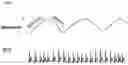 Fig. 01 - Respiratory rate detection using decomposition of ECG