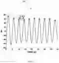 Fig. 08 - Respiratory rate detection using decomposition of ECG