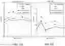 Fig. 07 - Methods for modeling neurological development and diagnosing a neurological impairment of a patient