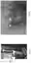 Fig. 06 - SYSTEM AND METHOD FOR NONINVASIVE EVALUATION OF PROSTHESIS LOOSENING, AND/OR FRACTURE HEALING