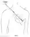Fig. 02 - SENSING FOR HEART FAILURE MANAGEMENT