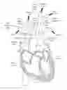 Fig. 01 - Implantable damping devices for treating dementia and associated systems and methods of use
