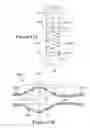 Fig. 12 - Implantable damping devices for treating dementia and associated systems and methods of use