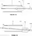 Fig. 09 - Thrombus retrieval stents and methods of using for treatment of ischemic stroke