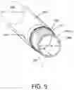 Fig. 06 - Surgical fluid management systems and methods