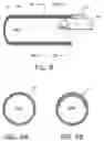Fig. 09 - Surgical fluid management systems and methods