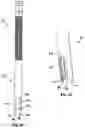 Fig. 09 - Spinal fixation system