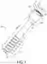 Fig. 02 - Orthopedic implant assemblies and devices