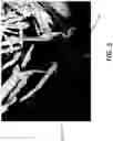 Fig. 06 - MILLED BONE GRAFT MATERIALS AND METHODS OF USE