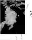 Fig. 07 - MILLED BONE GRAFT MATERIALS AND METHODS OF USE