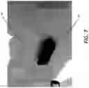 Fig. 08 - MILLED BONE GRAFT MATERIALS AND METHODS OF USE