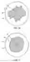 Fig. 08 - Soft balloon device and system