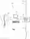 Fig. 02 - Methods and templates for shaping patient-specific anatomical-fixation implants