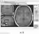 Fig. 22 - Image processing circuits for real-time visualizations using MRI image data and predefined data of surgical tools