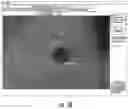 Fig. 33 - Image processing circuits for real-time visualizations using MRI image data and predefined data of surgical tools