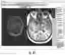 Fig. 35 - Image processing circuits for real-time visualizations using MRI image data and predefined data of surgical tools