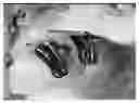 Fig. 01 - Orthodontic device for overbite correction