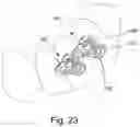 Fig. 28 - Orthodontic device for overbite correction