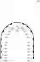 Fig. 01 - Orthodontic device