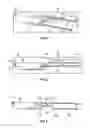 Fig. 03 - Surgical tools and joint kinematic reconstruction techniques
