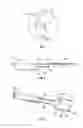 Fig. 04 - Surgical tools and joint kinematic reconstruction techniques