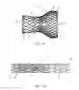 Fig. 02 - Assemblies and methods of sterilizing a wet stored implant