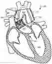 Fig. 01 - PERCUTANEOUSLY-DEPLOYABLE INTRAVASCULAR EMBOLIC PROTECTION DEVICES AND METHODS