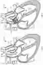 Fig. 02 - PERCUTANEOUSLY-DEPLOYABLE INTRAVASCULAR EMBOLIC PROTECTION DEVICES AND METHODS