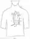 Fig. 06 - PERCUTANEOUSLY-DEPLOYABLE INTRAVASCULAR EMBOLIC PROTECTION DEVICES AND METHODS