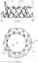 Fig. 08 - Multi-level cardiac implant