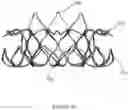 Fig. 09 - Multi-level cardiac implant