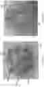 Fig. 22 - Multi-level cardiac implant