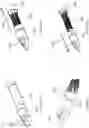 Fig. 45 - Multi-level cardiac implant