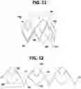 Fig. 07 - Structural members for prosthetic mitral valves
