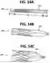 Fig. 09 - Structural members for prosthetic mitral valves