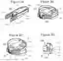 Fig. 04 - Expansible intersomatic cage