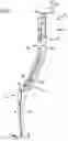 Fig. 02 - Hip joint endoprosthesis system