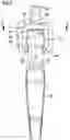 Fig. 04 - Hip joint endoprosthesis system
