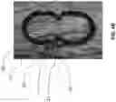 Fig. 06 - X-ray markers for scaffolds