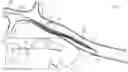 Fig. 01 - Method and apparatus for occlusion removal