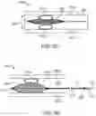 Fig. 22 - Method and apparatus for occlusion removal