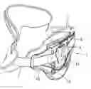 Fig. 01 - Rear sheet adjustment assembly of neck collar