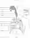 Fig. 03 - Mandibular repositioning device