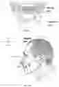 Fig. 06 - Mandibular repositioning device
