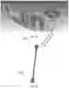 Fig. 16 - Mandibular repositioning device