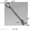 Fig. 20 - Mandibular repositioning device