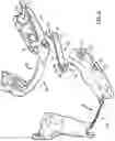 Fig. 09 - Mandibular protrusion device