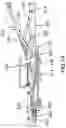 Fig. 14 - METHOD FOR PLACING A PATIENT SUPPORT DEVICE IN A VASCULAR POSITION