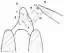 Fig. 01 - Composition for air polishing