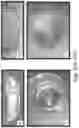 Fig. 48 - Stable silk fibroin based pharmaceutical formulations